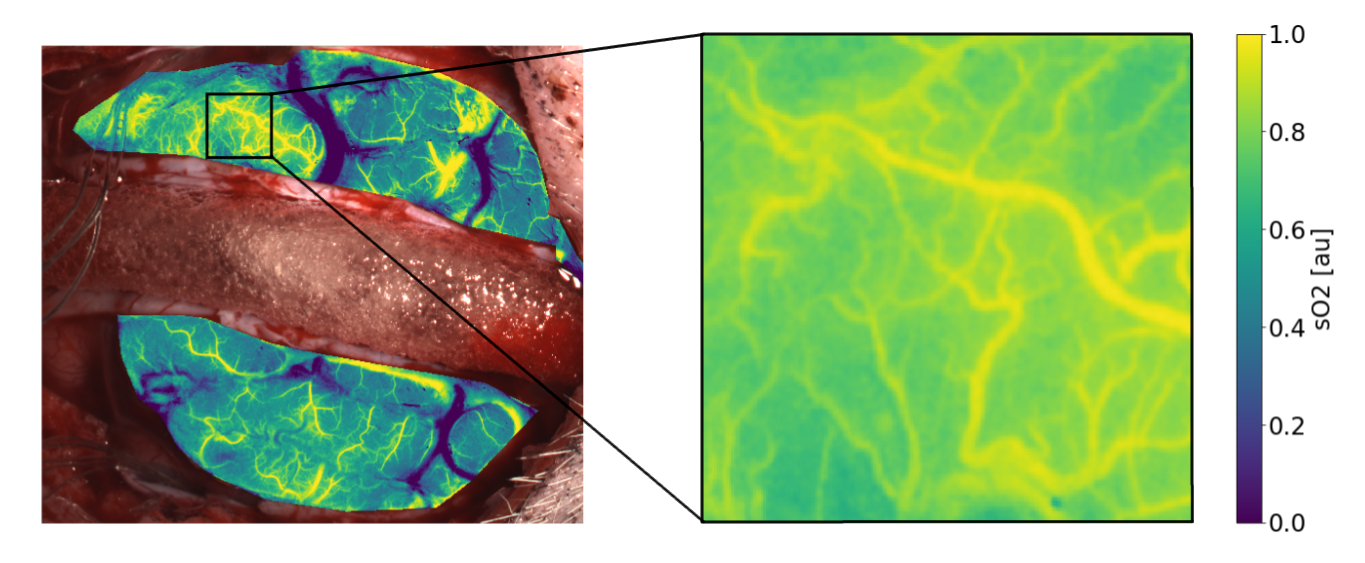 Beispiel der Gewebeparameter-Inferenz mit Unsicherheitsquantifizierung